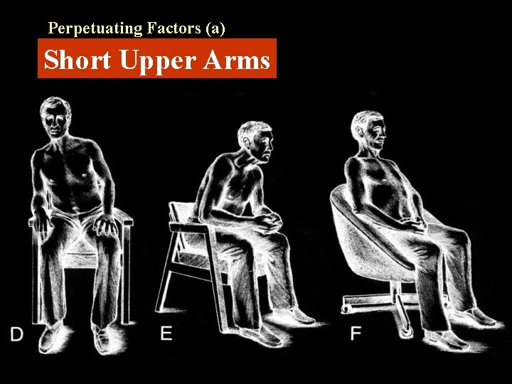 Perpetuating Factors (a) Short Upper Arms 