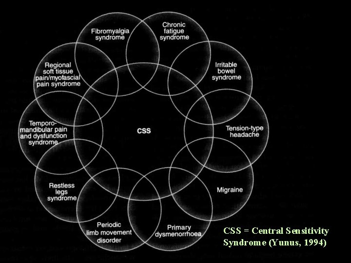 CSS = Central Sensitivity Syndrome (Yunus, 1994) 