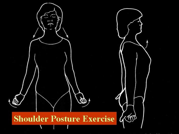 Shoulder Posture Exercise 