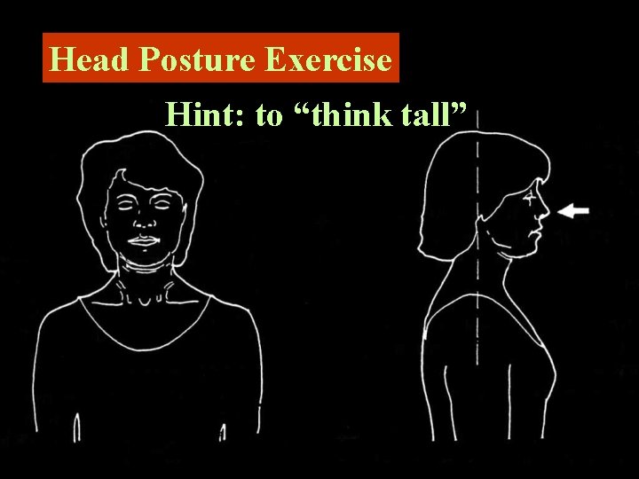 Head Posture Exercise Hint: to “think tall” 