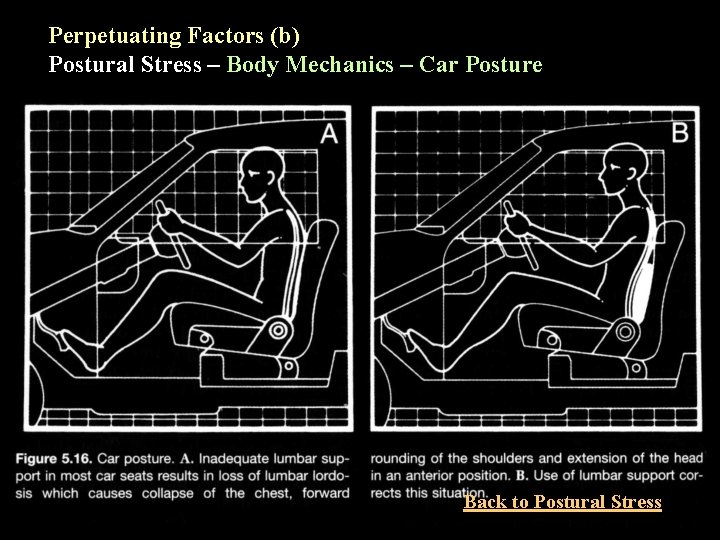 Perpetuating Factors (b) Postural Stress – Body Mechanics – Car Posture Back to Postural