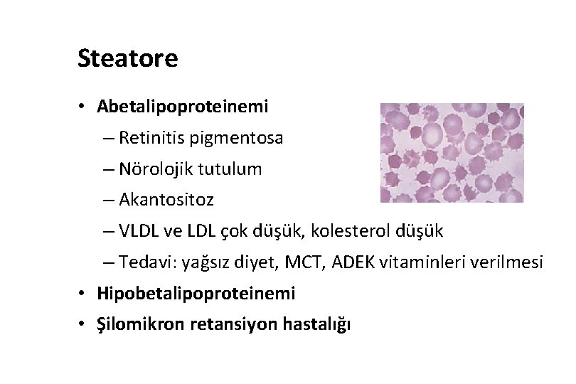 Steatore • Abetalipoproteinemi – Retinitis pigmentosa – Nörolojik tutulum – Akantositoz – VLDL ve