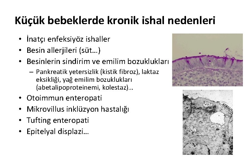 Küçük bebeklerde kronik ishal nedenleri • İnatçı enfeksiyöz ishaller • Besin allerjileri (süt…) •
