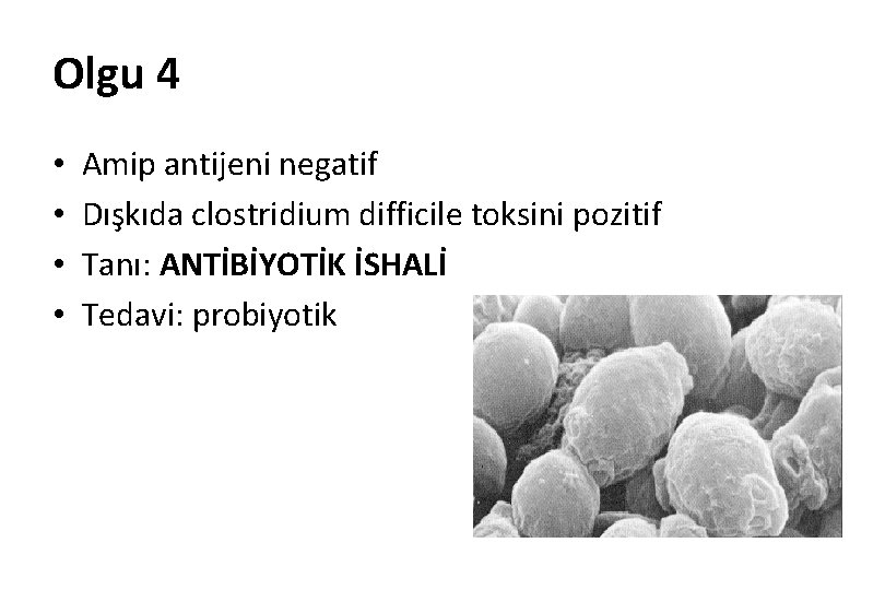 Olgu 4 • • Amip antijeni negatif Dışkıda clostridium difficile toksini pozitif Tanı: ANTİBİYOTİK