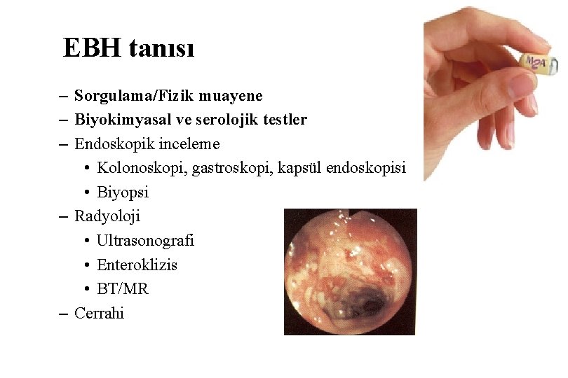 EBH tanısı – Sorgulama/Fizik muayene – Biyokimyasal ve serolojik testler – Endoskopik inceleme •