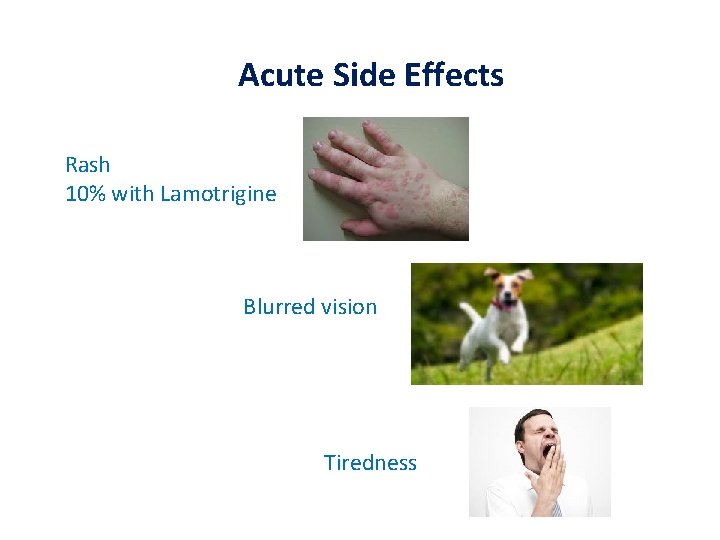 Acute Side Effects Rash 10% with Lamotrigine Blurred vision Tiredness 