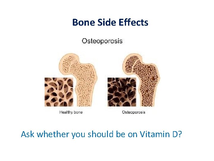 Bone Side Effects Ask whether you should be on Vitamin D? 