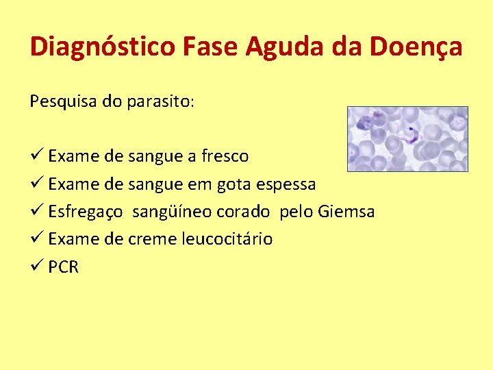 Diagnóstico Fase Aguda da Doença Pesquisa do parasito: ü Exame de sangue a fresco