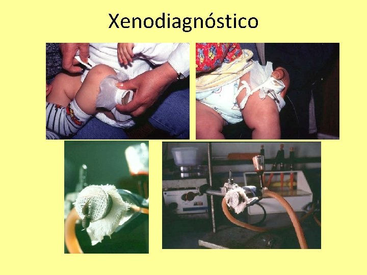 Xenodiagnóstico 