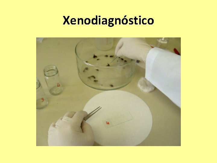 Xenodiagnóstico 