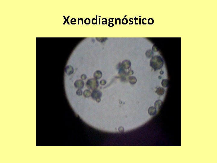 Xenodiagnóstico 