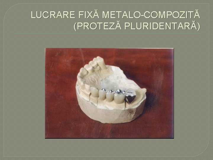 LUCRARE FIXĂ METALO COMPOZITĂ (PROTEZĂ PLURIDENTARĂ) LUCRARE FIXĂ METALO COMPOZITĂ (PROTEZĂ PLURIDENTARĂ)