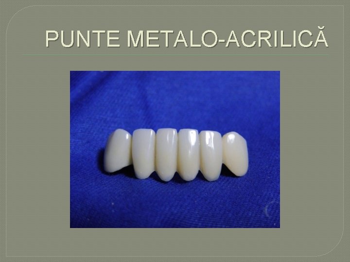 PUNTE METALO ACRILICĂ PUNTE METALO ACRILICĂ