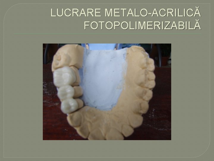 LUCRARE METALO ACRILICĂ FOTOPOLIMERIZABILĂ LUCRARE METALO ACRILICĂ FOTOPOLIMERIZABILĂ