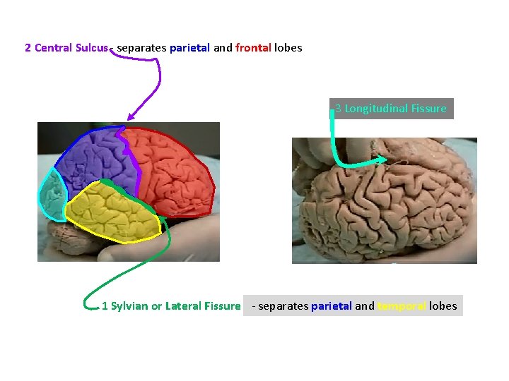 2 Central Sulcus - separates parietal and frontal lobes 3 Longitudinal Fissure 1 Sylvian