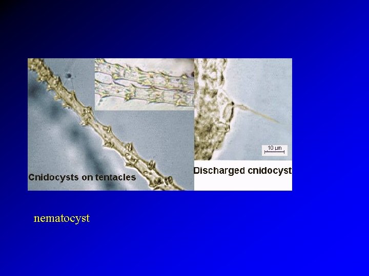 nematocyst 