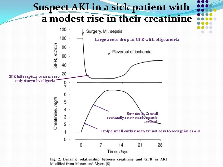 Suspect AKI in a sick patient with a modest rise in their creatinine Large