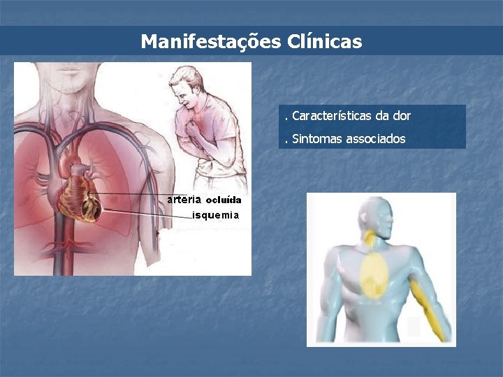 Manifestações Clínicas . Características da dor. Sintomas associados 