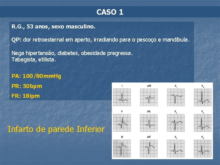 CASO 1 R. G. , 53 anos, sexo masculino. QP: dor retroesternal em aperto,