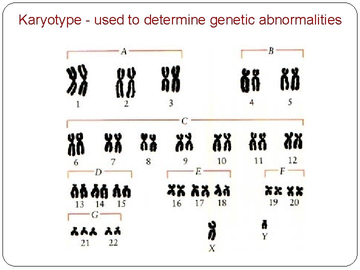 Karyotype - used to determine genetic abnormalities 