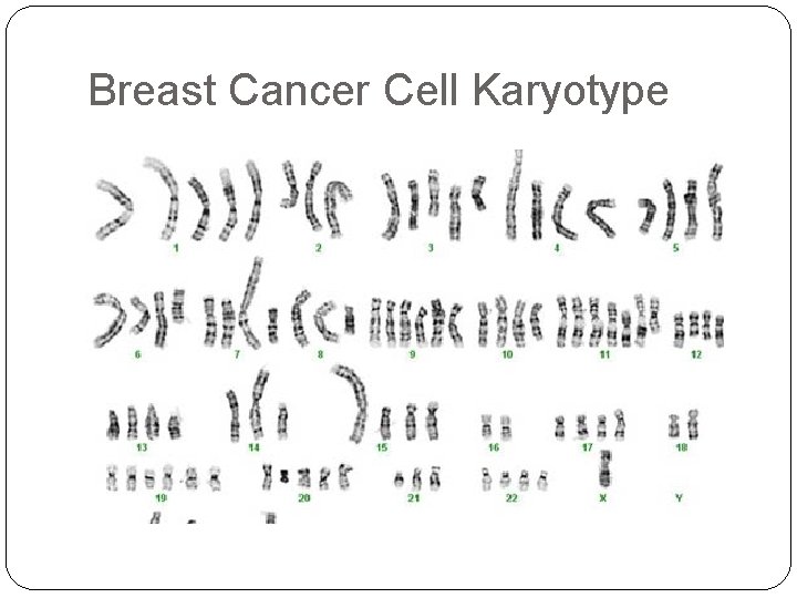 Breast Cancer Cell Karyotype 