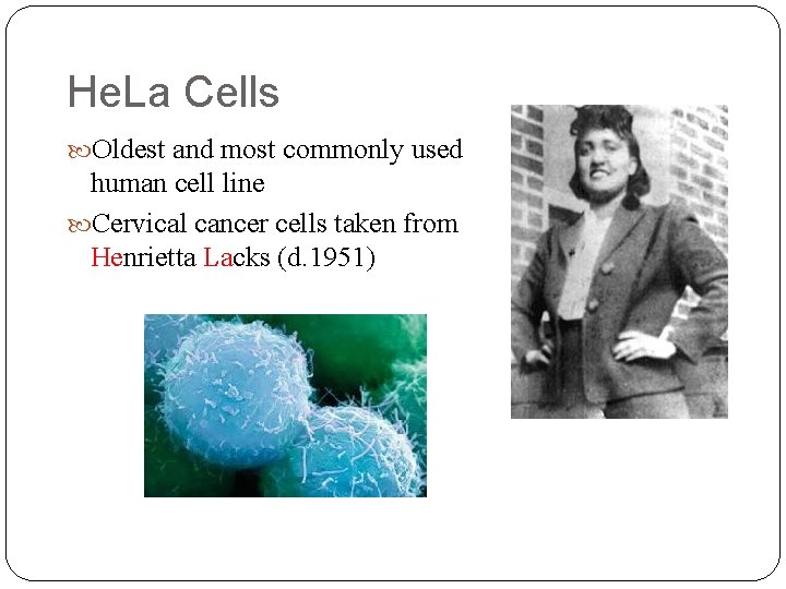 He. La Cells Oldest and most commonly used human cell line Cervical cancer cells