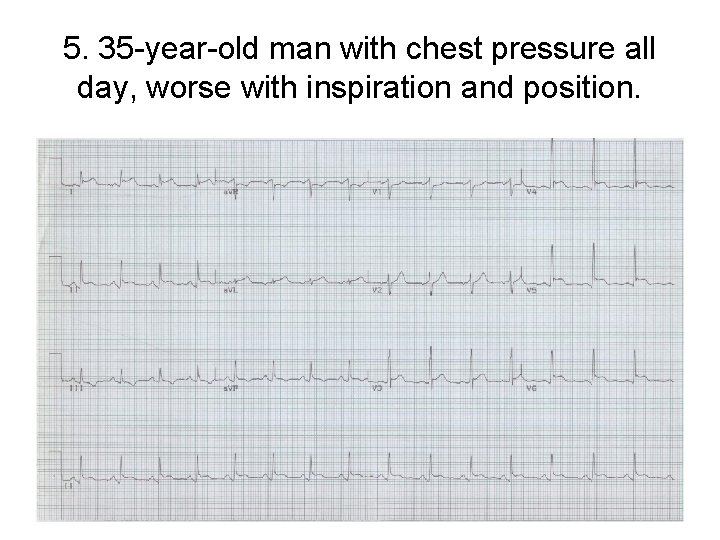 5. 35 -year-old man with chest pressure all day, worse with inspiration and position.