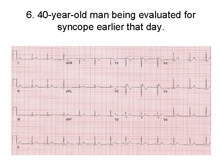 6. 40 -year-old man being evaluated for syncope earlier that day. 
