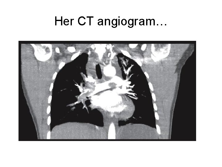 Her CT angiogram… 