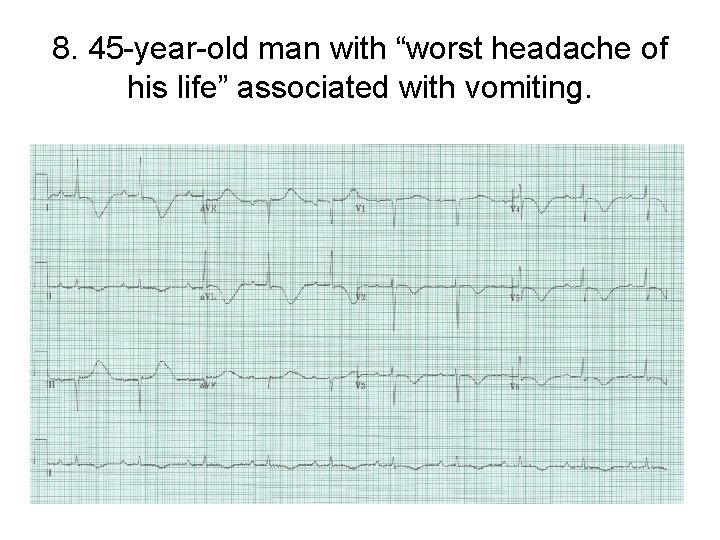 8. 45 -year-old man with “worst headache of his life” associated with vomiting. 