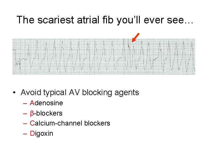 The scariest atrial fib you’ll ever see… • Avoid typical AV blocking agents –