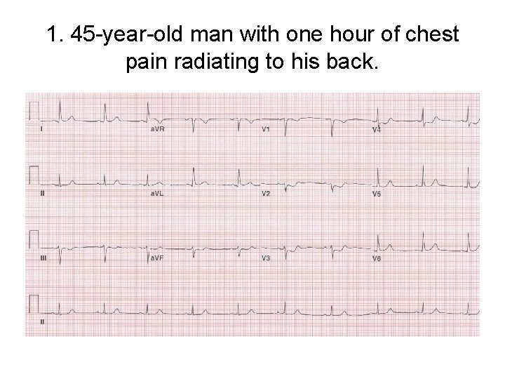 1. 45 -year-old man with one hour of chest pain radiating to his back.