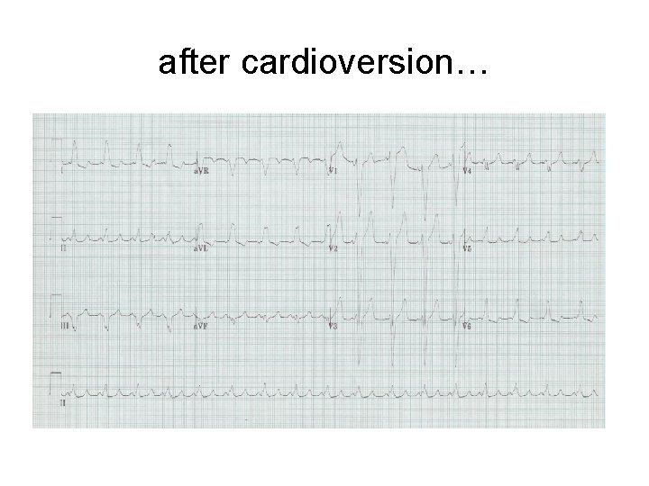 after cardioversion… 