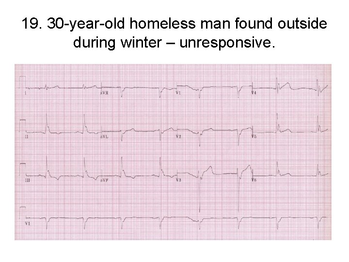 19. 30 -year-old homeless man found outside during winter – unresponsive. 