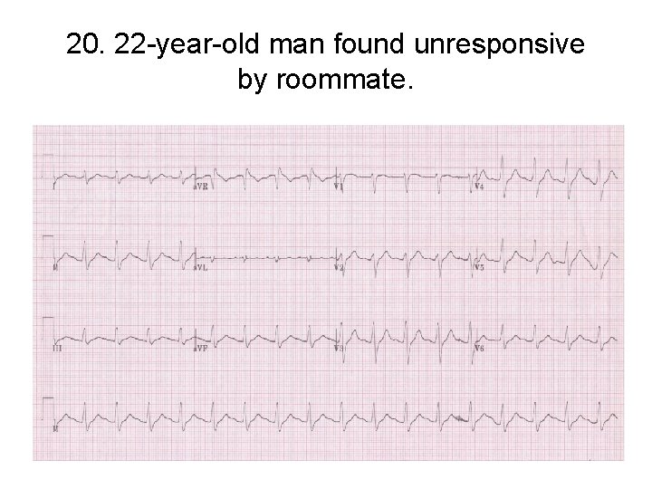 20. 22 -year-old man found unresponsive by roommate. 