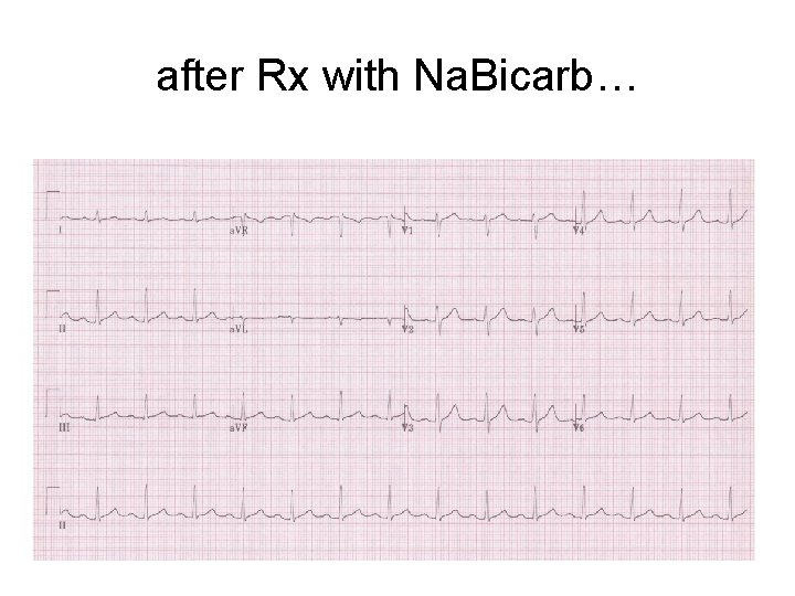 after Rx with Na. Bicarb… 