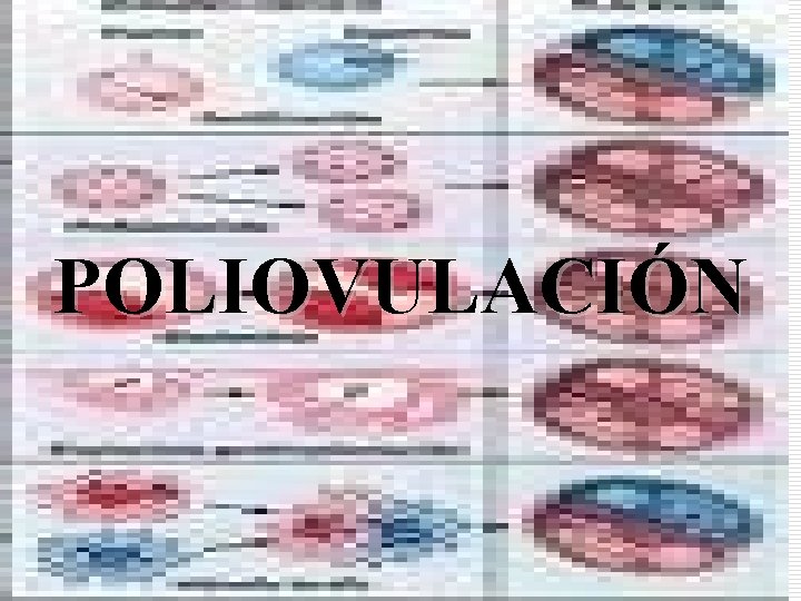 POLIOVULACIÓN POLIOVULACIÓN