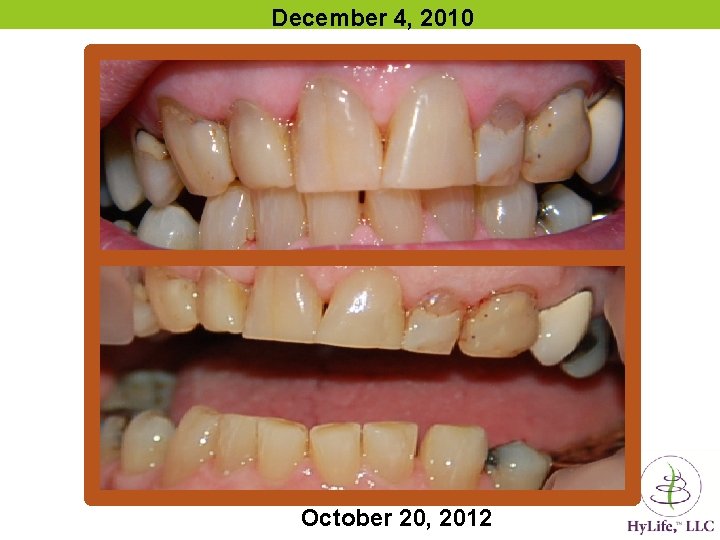 December 4, 2010 October 20, 2012 December 4, 2010 October 20, 2012