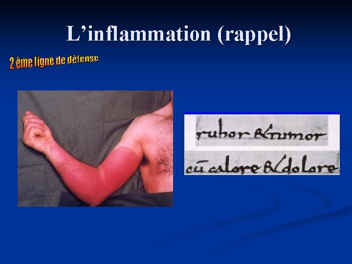 L’inflammation (rappel) 