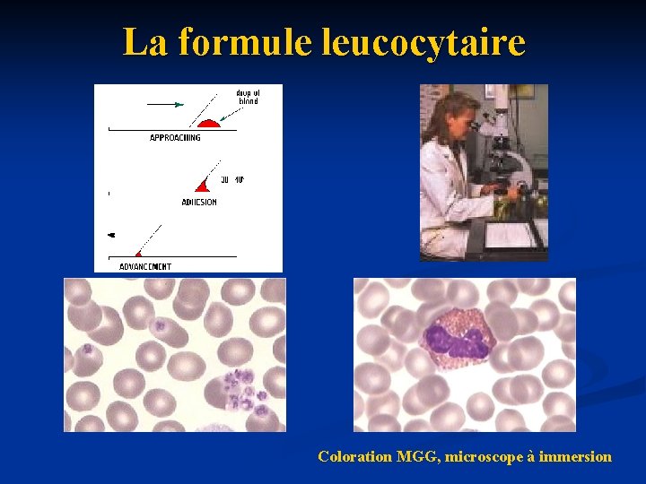 La formule leucocytaire Coloration MGG, microscope à immersion 