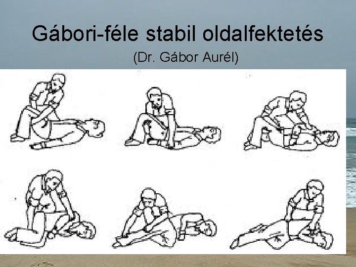 Gábori-féle stabil oldalfektetés (Dr. Gábor Aurél) 