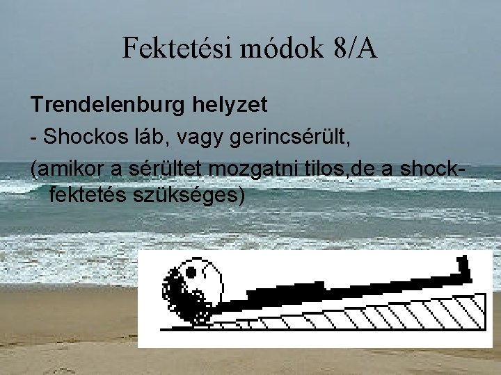 Fektetési módok 8/A Trendelenburg helyzet - Shockos láb, vagy gerincsérült, (amikor a sérültet mozgatni