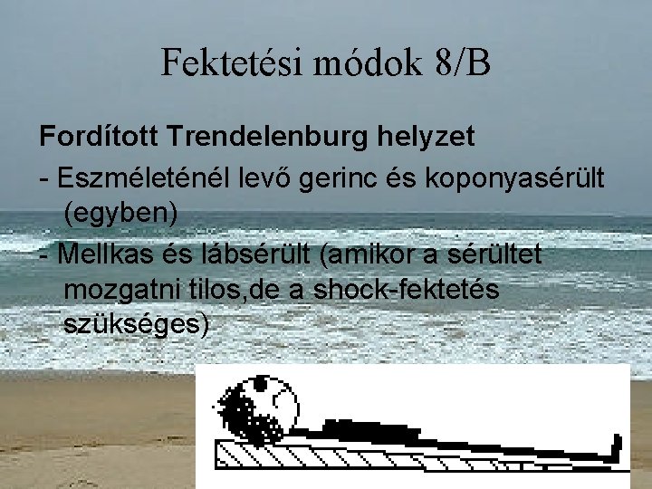 Fektetési módok 8/B Fordított Trendelenburg helyzet - Eszméleténél levő gerinc és koponyasérült (egyben) -