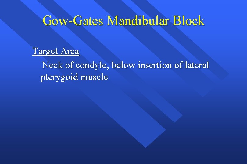 Gow-Gates Mandibular Block Target Area Neck of condyle, below insertion of lateral pterygoid muscle