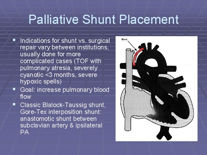 Palliative Shunt Placement § Indications for shunt vs. surgical repair vary between institutions, usually