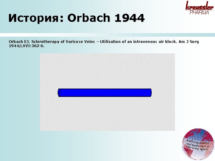История: Orbach 1944 Orbach EJ. Sclerotherapy of Varicose Veins – Utilization of an intravenous