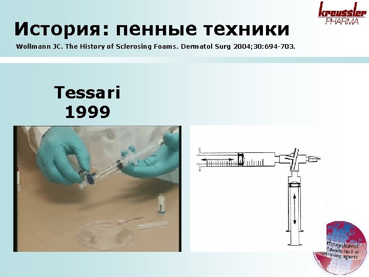 История: пенные техники Wollmann JC. The History of Sclerosing Foams. Dermatol Surg 2004; 30: