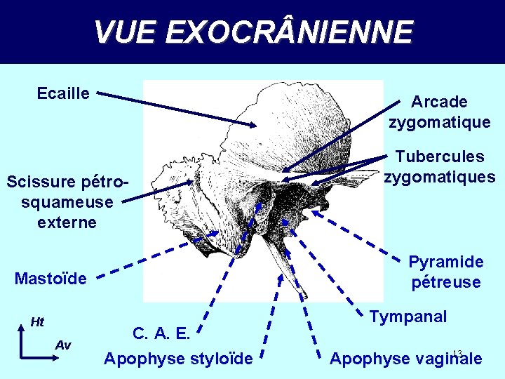 VUE EXOCR NIENNE Ecaille Arcade zygomatique Scissure pétrosquameuse externe Pyramide pétreuse Mastoïde Ht Av