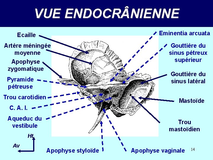 VUE ENDOCR NIENNE Eminentia arcuata Ecaille Artère méningée moyenne Apophyse zygomatique Pyramide pétreuse Trou