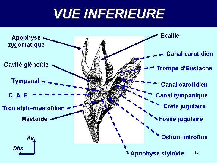 VUE INFERIEURE Apophyse zygomatique Ecaille Canal carotidien Cavité glénoïde Tympanal C. A. E. Trou